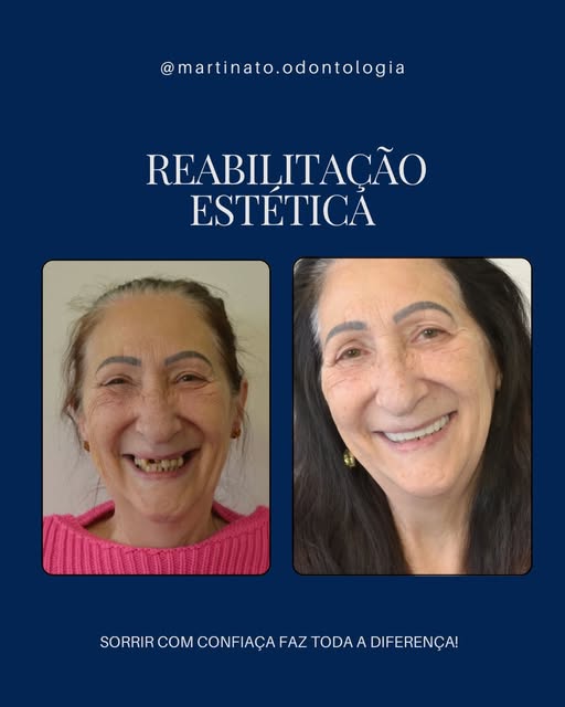 Resultado de tratamento estético