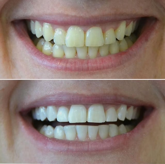 Post do Instagram da Martinato Odontologia